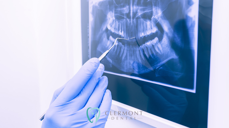 dental xrays