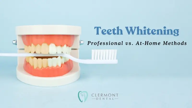 Teeth Whitening Services