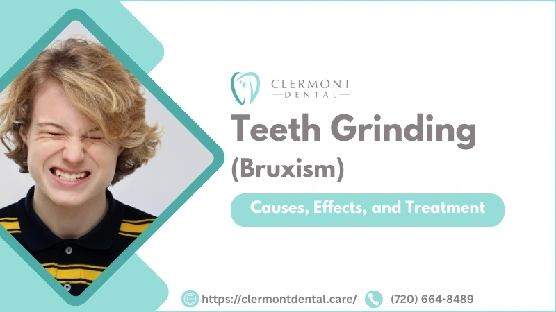 Teeth Grinding Bruxism Treatment